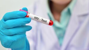 HIV KAISE HOTA HAI NEWS VERSAL